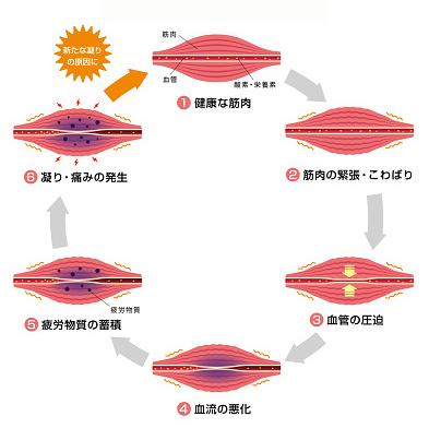 Process of muscle's stiffness and pain / circle type illustration ( japanese)
